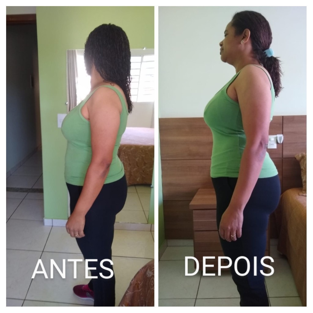 ante e depois botanical slim 1