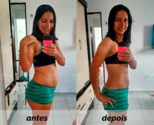 img-antes-depois-bc-cibele-a6a0a7f6-300x244
